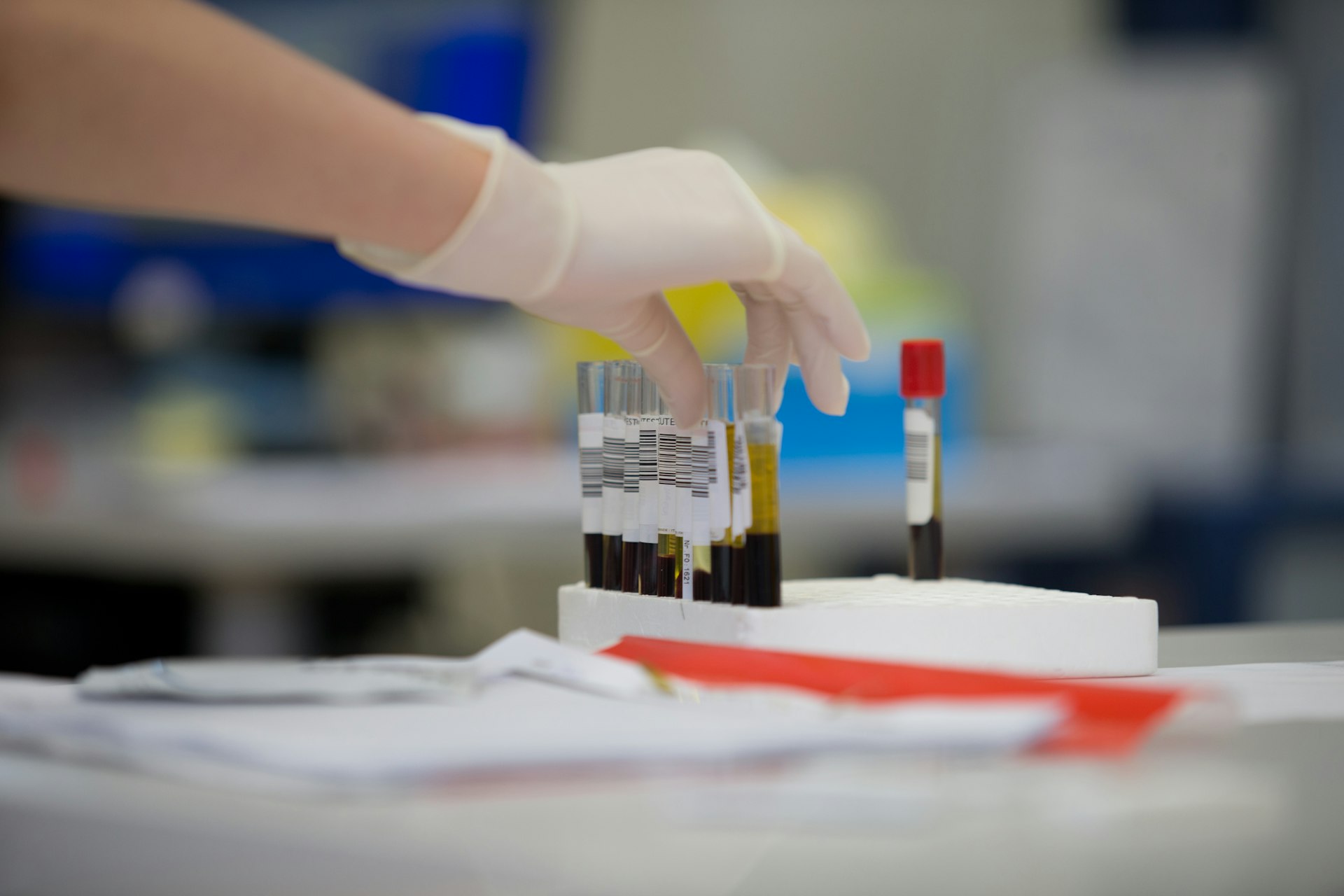 a gloved hand holding a test tube filled with blood